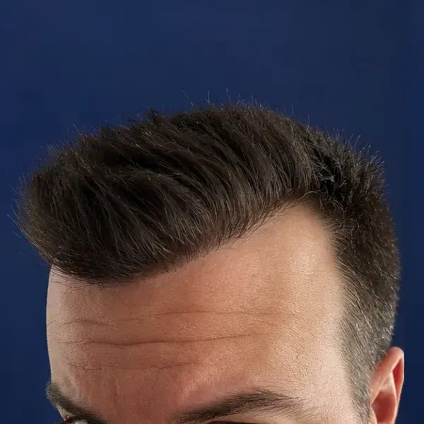 Frontal después