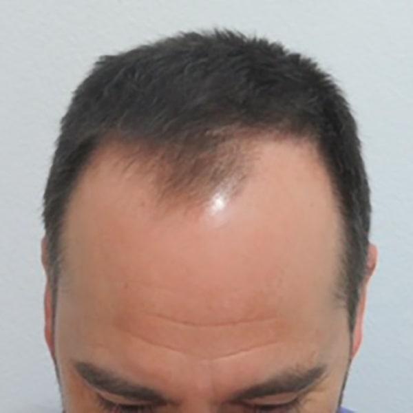 Caso 16 antes