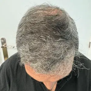 Caso 2 · Aéreo después