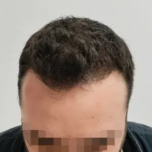 Caso 1 · Frontal después