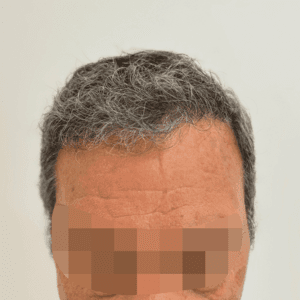 Caso 2 · Frontal después